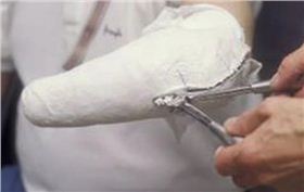 瑞典大学生开发出易于操作的3D打印定制假肢工艺