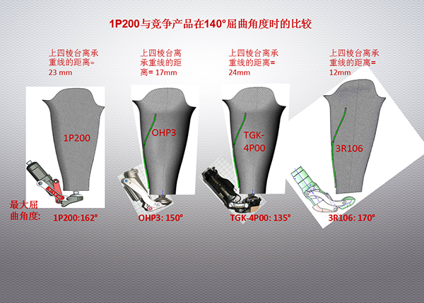 屈曲角度的比较