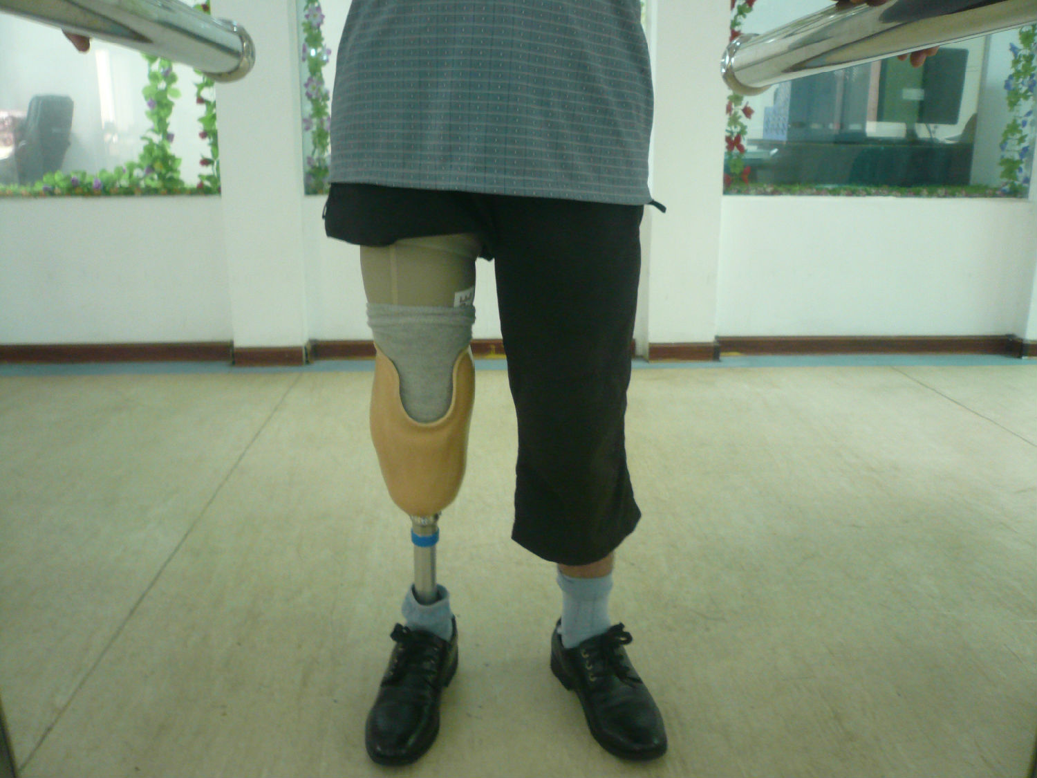 膝关节脱位，前后交叉韧带及内侧副韧带损伤，一期重建。 - 微医（挂号网）
