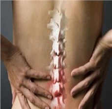 不花钱，最简单的【腰间盘突出症】治疗方式