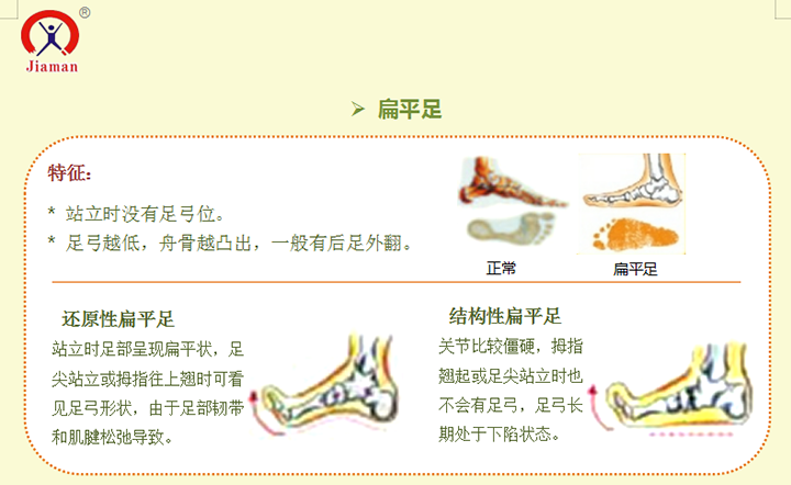 症状:高弓足,扁平足