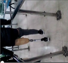 初装大腿假肢步行训练视频|佳满假肢