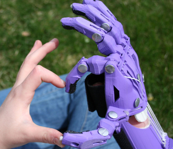 肢残儿童将获3D打印假肢