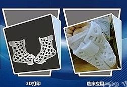 国内3D医学打印中心落户    总投资5000万元