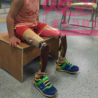 江西省为贫困截肢儿童免费安装假肢