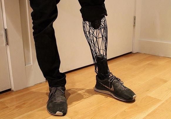 轻巧又便宜的透明3D钛假肢