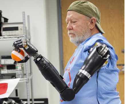 新传感器技术可实现意念操控机械假肢