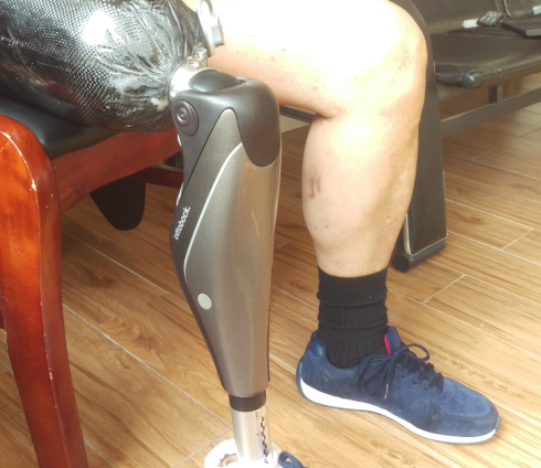 Genium智能大腿假肢上下楼梯训练视频 Genium智能大腿假肢上下楼梯训练视频