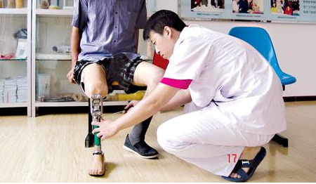 长沙今年免费为200位残疾人装配假肢