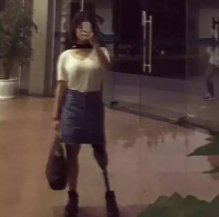 如果穿短裙把假肢露出来,走在大街上会怎样? 如果穿短裙把假肢露出来,走在大街上会怎样?