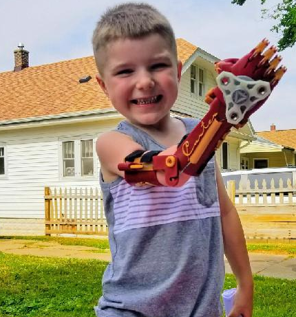 美国父亲为残疾儿子打造酷炫钢铁侠手臂 仅70元
