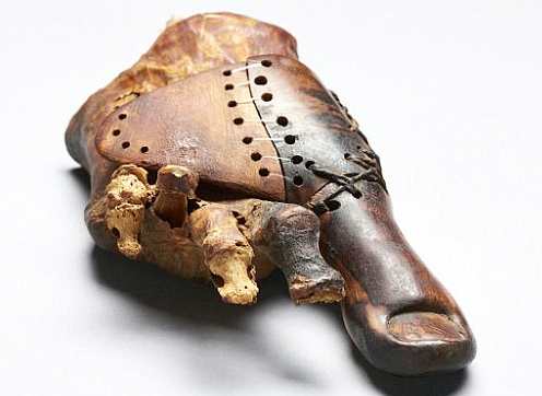 目前发现的最古老假肢