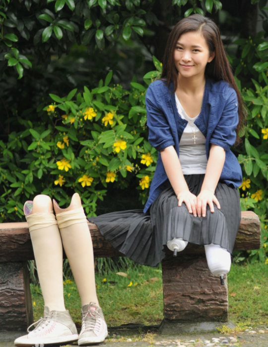 漂亮跳舞美女 双腿居然是假肢 漂亮跳舞美女 双腿居然是假肢