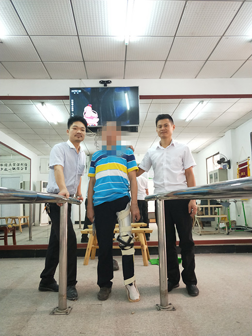 小儿麻痹患者装配大腿免荷矫形器