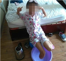九岁小女孩小腿假肢康复训练